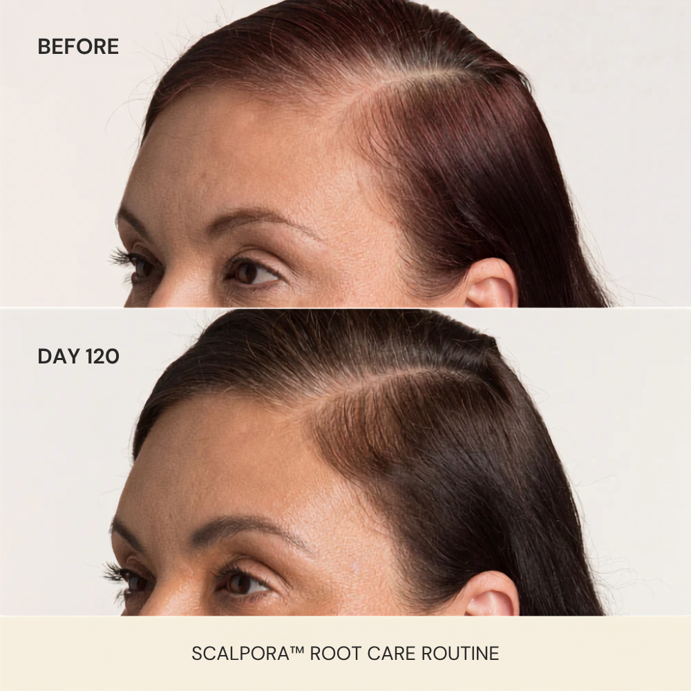 Scalpora™ Scalp Oil Applicator Comb