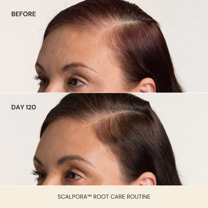Scalpora™ Scalp Oil Applicator Comb