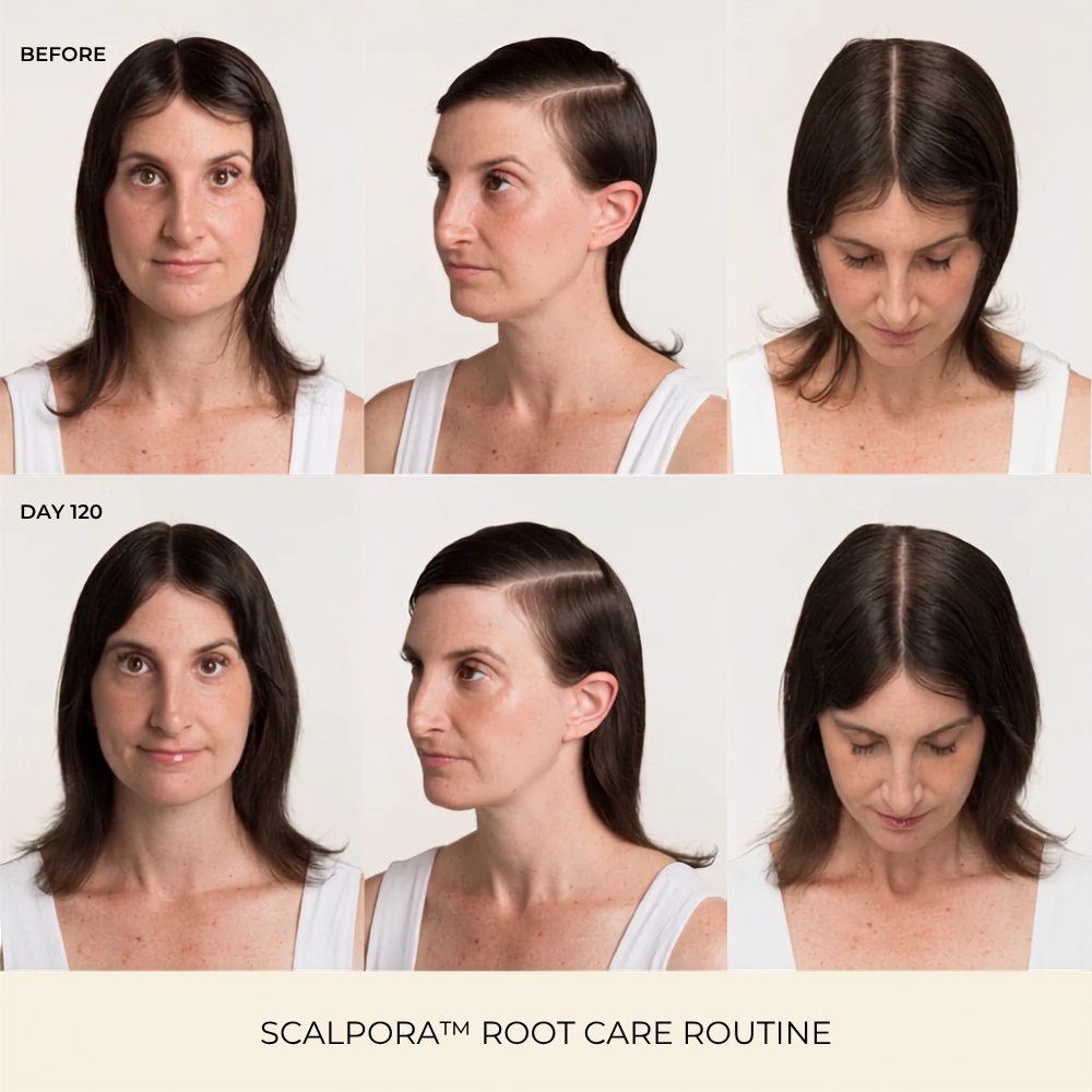 Scalpora™ Scalp Oil Applicator Comb