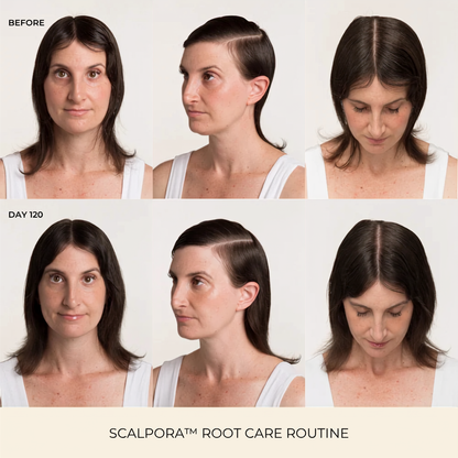 Scalpora™ Scalp Oil Applicator Comb